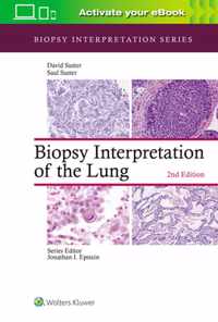 BIOPSY INTERPRETATION OF THE LUNG 2E CB