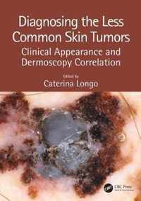 Diagnosing the Less Common Skin Tumors