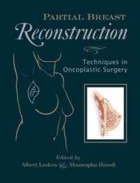 Partial Breast Reconstruction