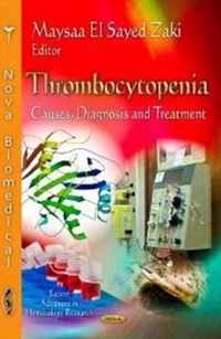 Thrombocytopenia