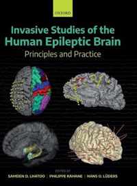 Invasive Studies of the Human Epileptic Brain