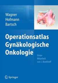 Operationsatlas Gynkologische Onkologie