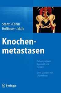 Knochenmetastasen