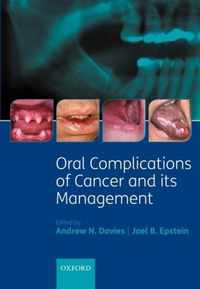 Oral Complications of Cancer and its Management