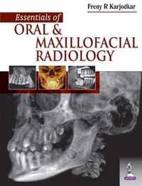 Essentials of Oral and Maxillofacial Radiology