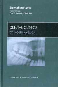 Dental Implants, An Issue of Dental Clinics