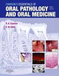 Cawson's Essentials of Oral Pathology and Oral Medicine