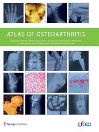 Atlas of Osteoarthritis