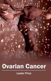 Ovarian Cancer