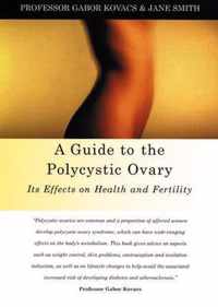 Guide To The Polycystic Ovary