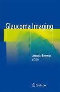 Glaucoma Imaging