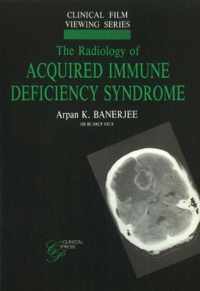 Radiology of Acquired Immune Deficiency Syndrome