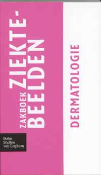 Zakboek Ziektebeelden  -  Zakboek ziektebeelden Dermatologie