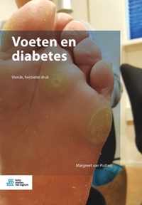 Voeten en diabetes