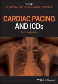 Cardiac Pacing and ICDs