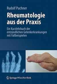 Rheumatologie Aus Der Praxis