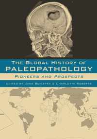 Global History Of Paleopathology