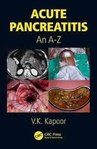 Acute Pancreatitis