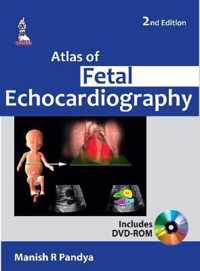 Atlas of Fetal Echocardiography