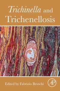 Trichinella and Trichinellosis