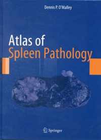 Atlas of Spleen Pathology