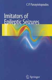 Imitators of epileptic seizures