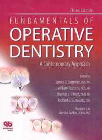 Fundamentals of Operative Dentistry