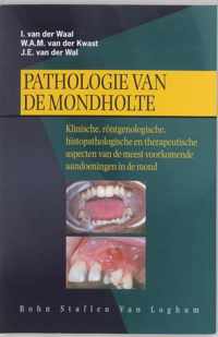 Pathologie van de mondholte