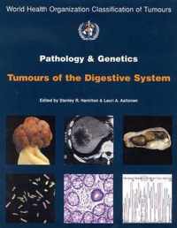 Pathology and Genetics of Tumours of the Digestive System