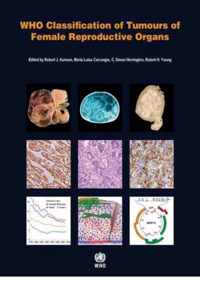 WHO classification of tumours of the lung, plura, thymus and heart