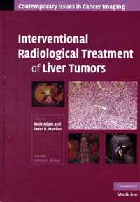 Interventional Radiological Treatment of Liver Tumors