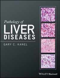 Pathology of Liver Diseases