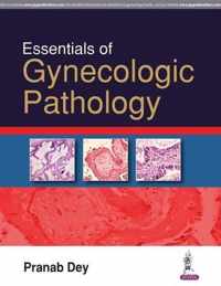 Essentials of Gynecologic Pathology