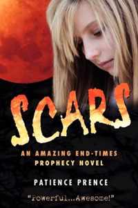 Scars