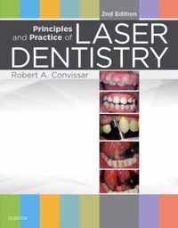 Principles & Practice Of Laser Dentistry