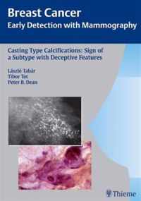 Casting-Type Calcifications