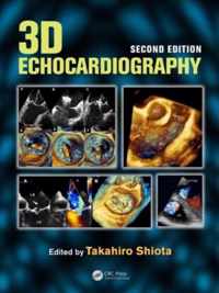 3D Echocardiography