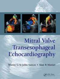 Mitral Valve Transesophageal Echocardiography