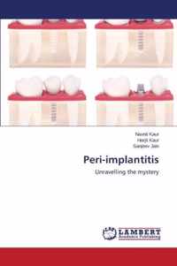 Peri-implantitis