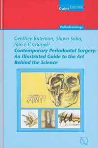 Contemporary Periodontal Surgery