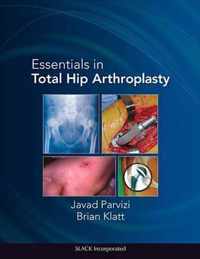 Essentials in Total Hip Arthroplasty