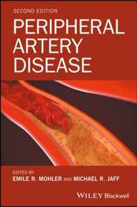 Peripheral Artery Disease