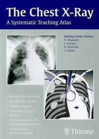 The Chest X-Ray