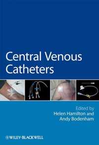 Central Venous Catheters