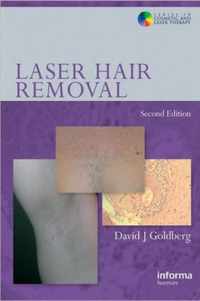 Laser Hair Removal