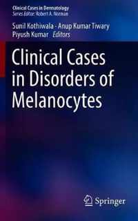 Clinical Cases in Disorders of Melanocytes