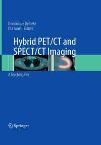 Hybrid PET/CT and SPECT/CT Imaging