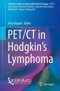 PET/CT in Hodgkin's Lymphoma