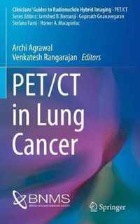 PET/CT in Lung Cancer