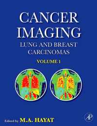 Cancer Imaging